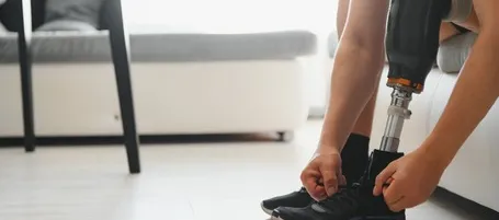 Man with amputation