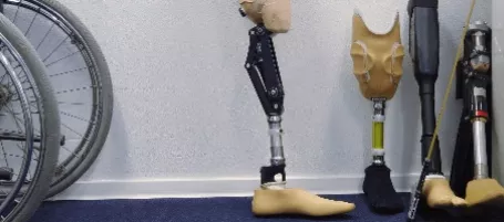 Image of amputation leg