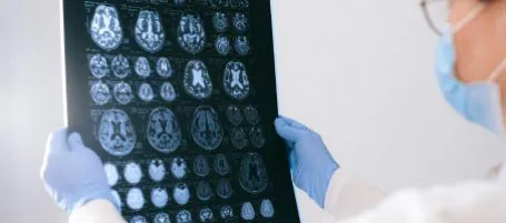 image of radiologists viewing image