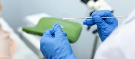 smear test