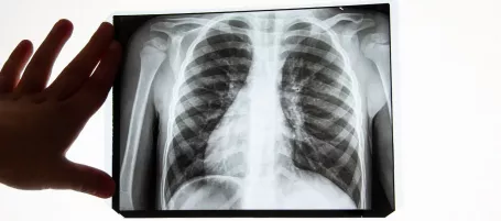 Image of lungs